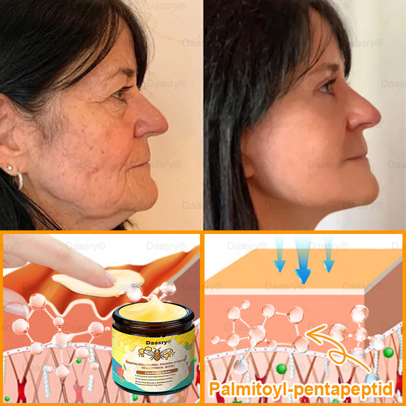 🔥 🗽Klinicky ověřeno: Daasry® Bee Venom Treatment Cream s peptidy včelího jedu, botulotoxinem, kyselinou hyaluronovou a kolagenem💧. Cílí na vrásky, jemné linky, ochabnutí pleti, strie, tmavé skvrny – zpevňuje, liftinguje a další účinky.