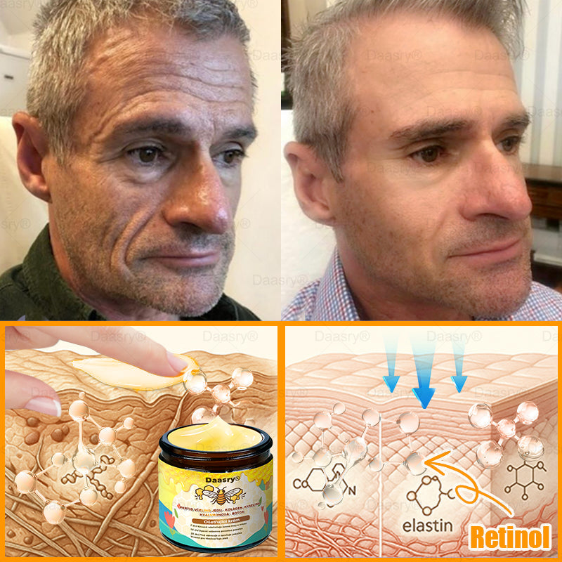 🔥 🗽Klinicky ověřeno: Daasry® Bee Venom Treatment Cream s peptidy včelího jedu, botulotoxinem, kyselinou hyaluronovou a kolagenem💧. Cílí na vrásky, jemné linky, ochabnutí pleti, strie, tmavé skvrny – zpevňuje, liftinguje a další účinky.