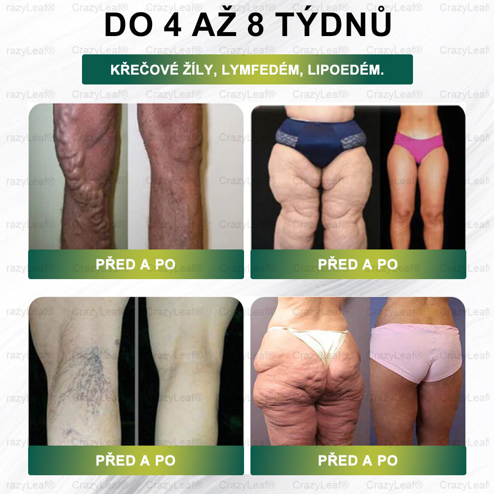 Oficiální obchod|CrazyLeaf® Meglutide GLP-1 aktivační perorální roztok - Moringa • NAD+ • Yerba Maté - přírodní podpora hubnutí, proti stárnutí a metabolismu cukru