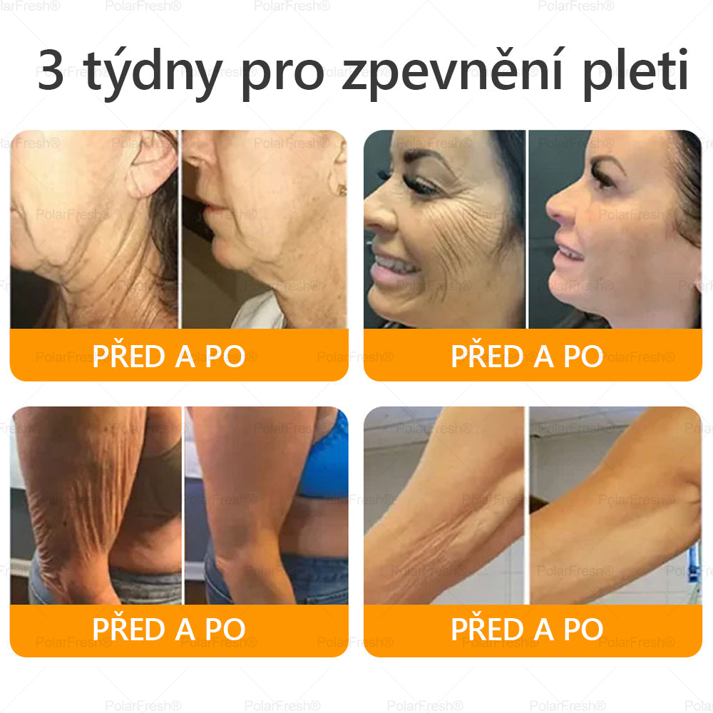🔥 🗽Klinicky ověřeno: Daasry® Bee Venom Treatment Cream s peptidy včelího jedu, botulotoxinem, kyselinou hyaluronovou a kolagenem💧. Cílí na vrásky, jemné linky, ochabnutí pleti, strie, tmavé skvrny – zpevňuje, liftinguje a další účinky.