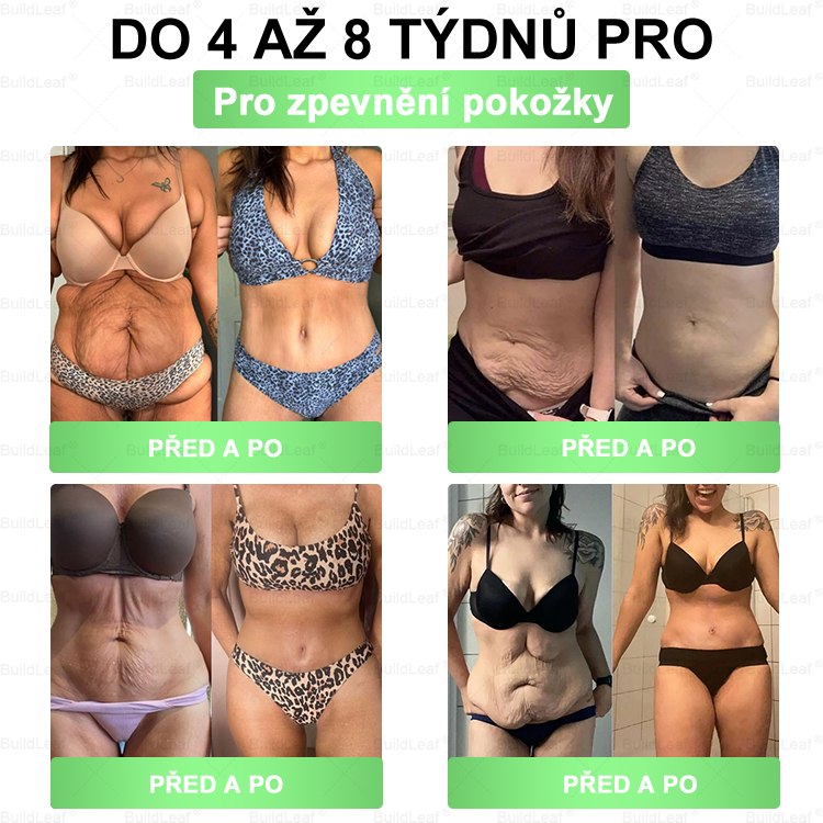 𝑩𝒖𝒊𝒍𝒅𝑳𝒆𝒂𝒇® 𝑮𝑳𝑷-1 8-𝒊𝒏-1 𝑺𝒍𝒊𝒎 & 𝑯𝒆𝒂𝒍𝒕𝒉𝒚 Ú𝒔𝒕𝒏í 𝒓𝒐𝒛𝒕𝒐𝒌(Jednou denně, viditelné výsledky za 7 dní). Podporuje boj s obezitou, zdraví kardiovaskulárního systému, diabetes, zdraví střev (Copy)