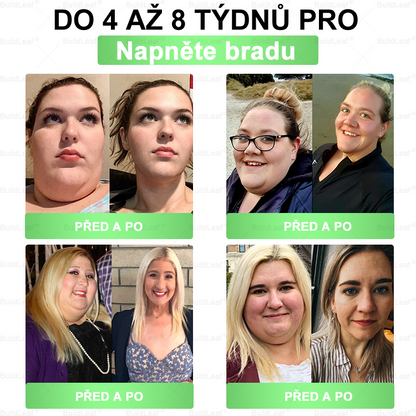 𝑩𝒖𝒊𝒍𝒅𝑳𝒆𝒂𝒇® 𝑮𝑳𝑷-1 8-𝒊𝒏-1 𝑺𝒍𝒊𝒎 & 𝑯𝒆𝒂𝒍𝒕𝒉𝒚 Ú𝒔𝒕𝒏í 𝒓𝒐𝒛𝒕𝒐𝒌(Jednou denně, viditelné výsledky za 7 dní). Podporuje boj s obezitou, zdraví kardiovaskulárního systému, diabetes, zdraví střev (Copy)
