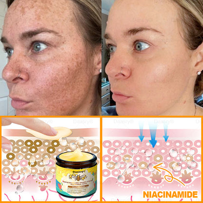 🔥 🗽Klinicky ověřeno: Daasry® Bee Venom Treatment Cream s peptidy včelího jedu, botulotoxinem, kyselinou hyaluronovou a kolagenem💧. Cílí na vrásky, jemné linky, ochabnutí pleti, strie, tmavé skvrny – zpevňuje, liftinguje a další účinky.