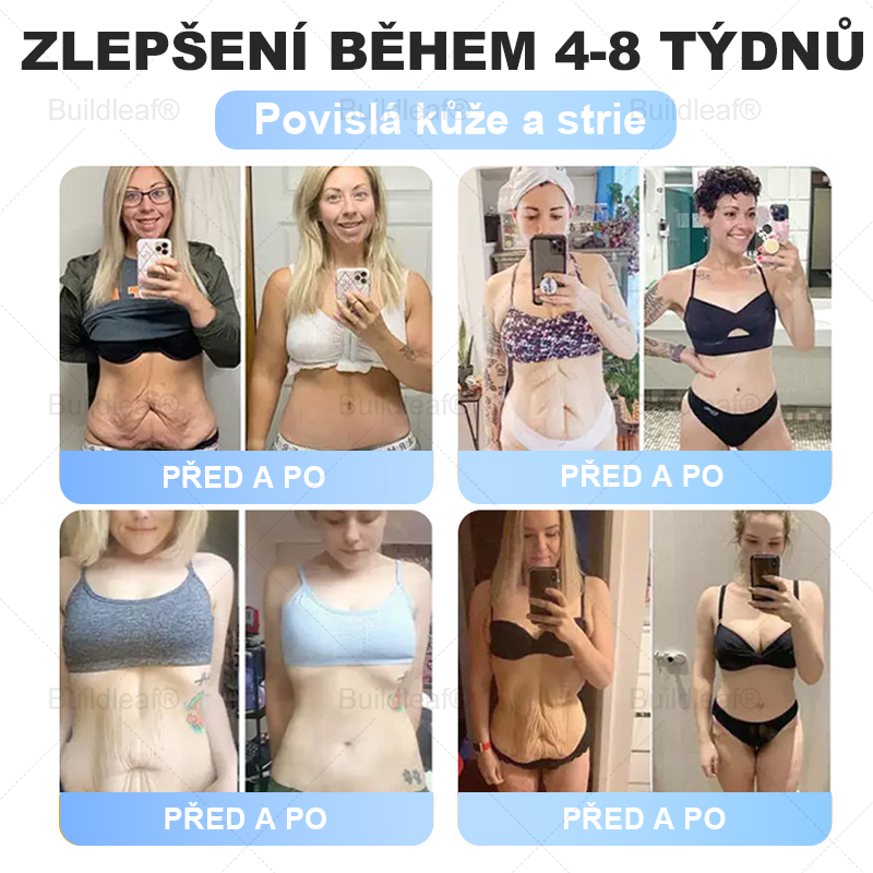 Oficiální obchod | Buildleaf® Tirzepatide Nano Mikroneedlový Náplast s kolagenem a Matrixyl 3000 | Proti obezitě, povolené pokožce, vysokému krevnímu tlaku, cukrovce, tukové játrech, bolesti kloubů, mozkové mlze, nízké energii, tělesné bolesti a dalších