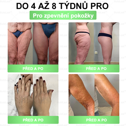 𝑩𝒖𝒊𝒍𝒅𝑳𝒆𝒂𝒇® 𝑮𝑳𝑷-1 8-𝒊𝒏-1 𝑺𝒍𝒊𝒎 & 𝑯𝒆𝒂𝒍𝒕𝒉𝒚 Ú𝒔𝒕𝒏í 𝒓𝒐𝒛𝒕𝒐𝒌(Jednou denně, viditelné výsledky za 7 dní). Podporuje boj s obezitou, zdraví kardiovaskulárního systému, diabetes, zdraví střev (Copy)