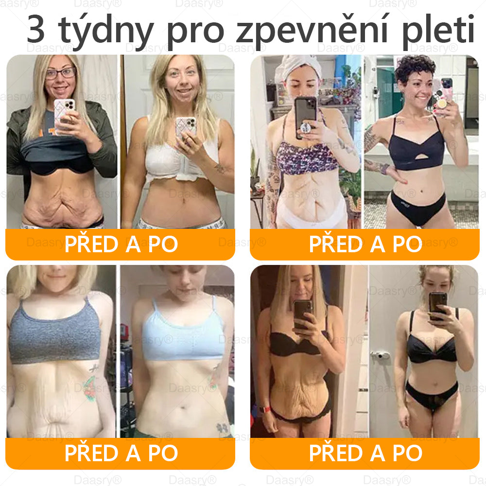 🔥 🗽Klinicky ověřeno: Daasry® Bee Venom Treatment Cream s peptidy včelího jedu, botulotoxinem, kyselinou hyaluronovou a kolagenem💧. Cílí na vrásky, jemné linky, ochabnutí pleti, strie, tmavé skvrny – zpevňuje, liftinguje a další účinky.
