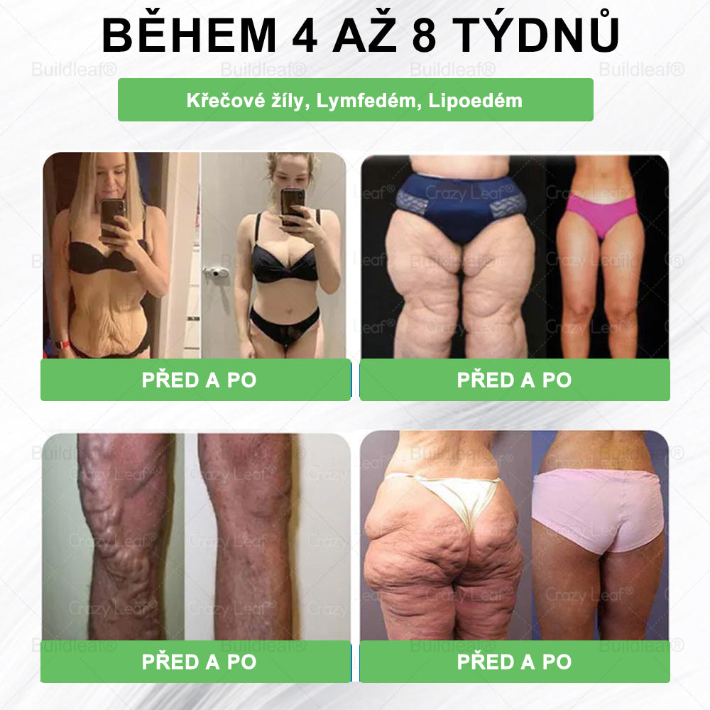 Oficiální obchod | BuildLeaf® GLP-1 6-v-1 Health Solution Perorální tekutina (Pouze jednou denně, viditelné změny za 7 dní) ✅ Pro obezitu, kardiovaskulární onemocnění, cukrovku, spánkovou apnoe, zdraví střev, problémy s klouby a další