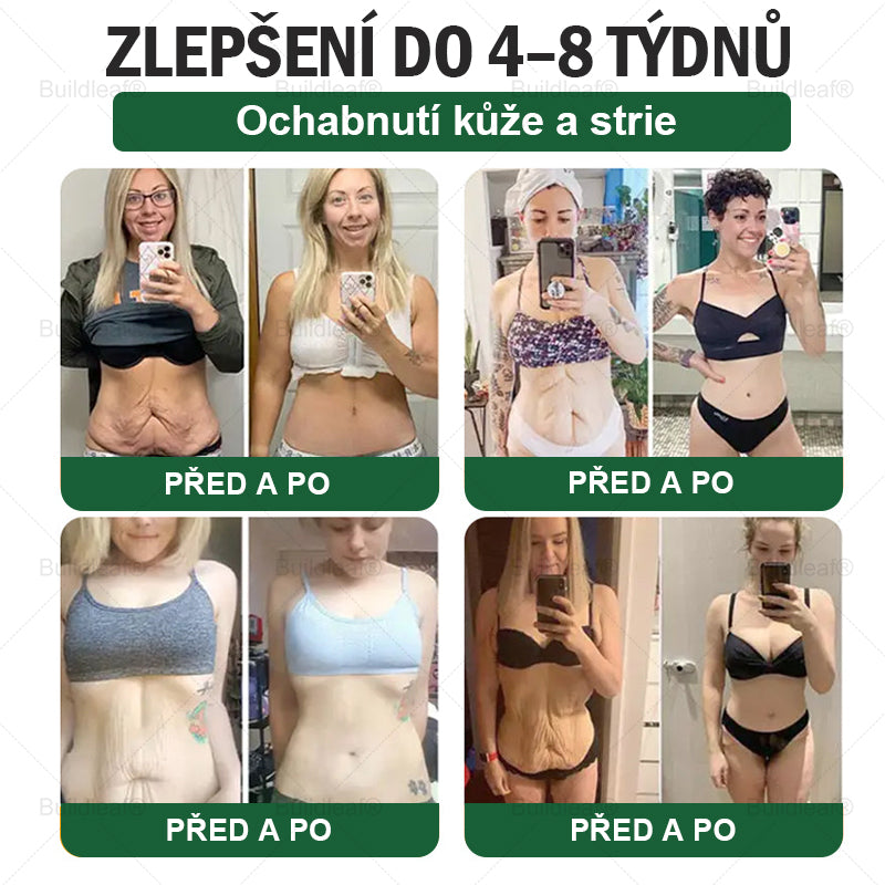 Oficiální obchod | BuildLeaf® GLP-1 6-v-1 Health Solution Perorální tekutina (Pouze jednou denně, viditelné změny za 7 dní) ✅ Pro obezitu, kardiovaskulární onemocnění, cukrovku, spánkovou apnoe, zdraví střev, problémy s klouby a další