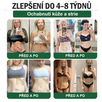 Oficiální obchod | BuildLeaf® GLP-1 6-v-1 Health Solution Perorální tekutina (Pouze jednou denně, viditelné změny za 7 dní) ✅ Pro obezitu, kardiovaskulární onemocnění, cukrovku, spánkovou apnoe, zdraví střev, problémy s klouby a další