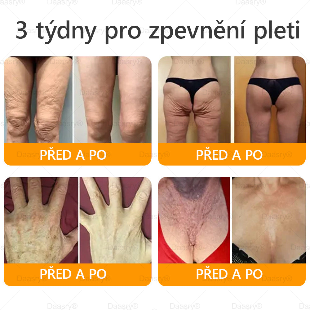🔥 🗽Klinicky ověřeno: Daasry® Bee Venom Treatment Cream s peptidy včelího jedu, botulotoxinem, kyselinou hyaluronovou a kolagenem💧. Cílí na vrásky, jemné linky, ochabnutí pleti, strie, tmavé skvrny – zpevňuje, liftinguje a další účinky.
